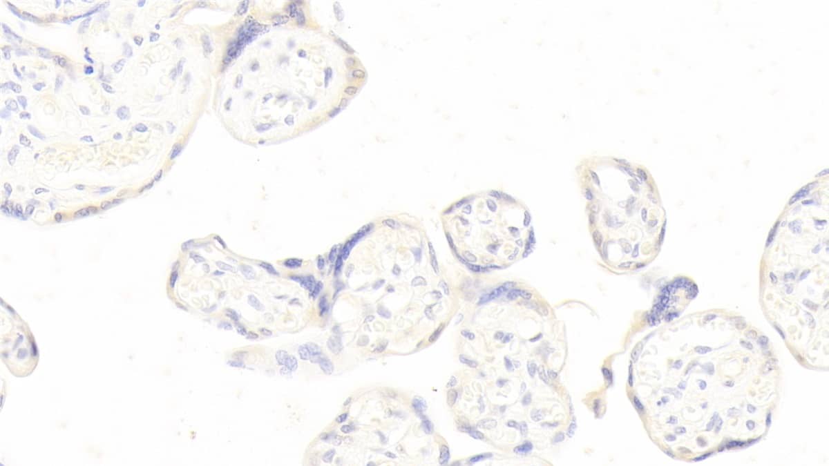 Pappalysin-1/PAPP-A Antibody (H6)