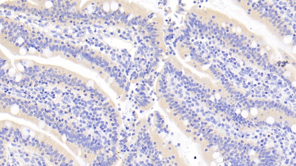 RNASE3 Antibody (C2)