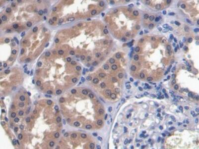 RNASE3 Antibody (C1)