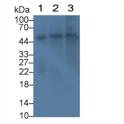 Reduced Folate Carrier/SLC19A1 Antibody (C1)