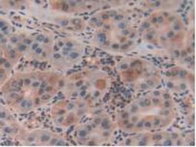 CLIC1 Antibody