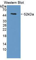LACRT Antibody