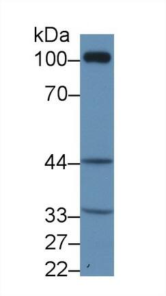 Thromboxane A2 R/TBXA2R Antibody