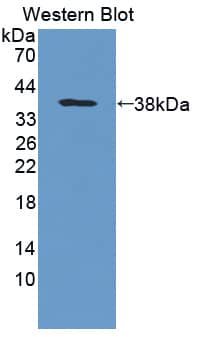 PTP gamma/PTPRG Antibody