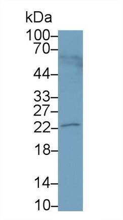 PRL-3/PTP4A3 Antibody