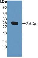 PRL-3/PTP4A3 Antibody