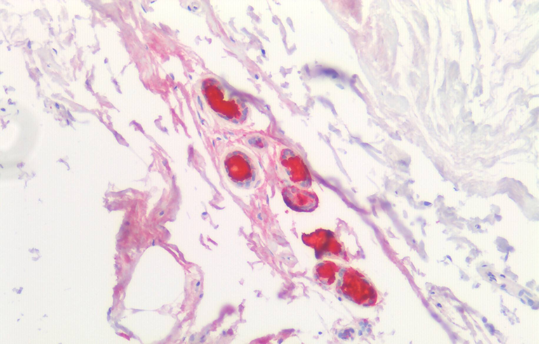 SCGB1D2 Antibody