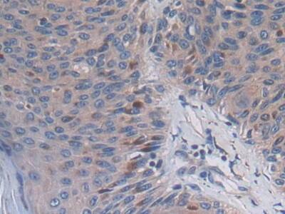 PC6 Antibody