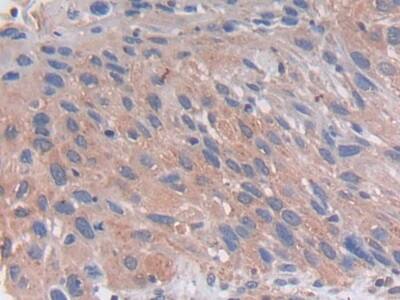 PC6 Antibody