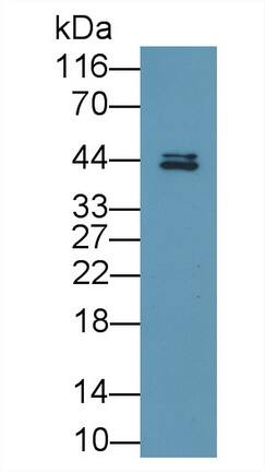 Fatty acid desaturase 2 Antibody