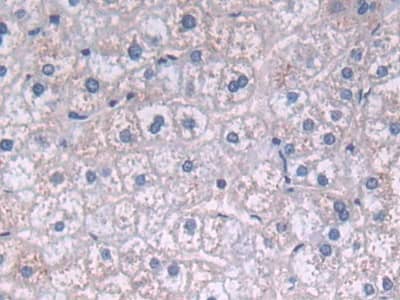 Fatty acid desaturase 2 Antibody