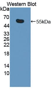 KIF18A Antibody