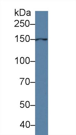 ANO6 Antibody