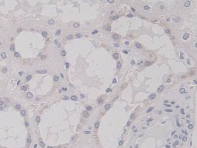 TNS3 Antibody