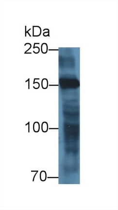 Myomesin 2 Antibody