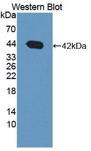BDH1 Antibody