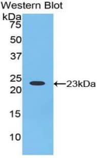 Hornerin Antibody