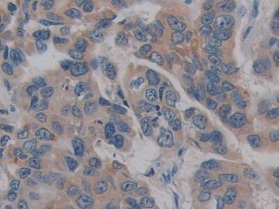 GPI-PLD/GPLD1 Antibody