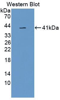 GPI-PLD/GPLD1 Antibody