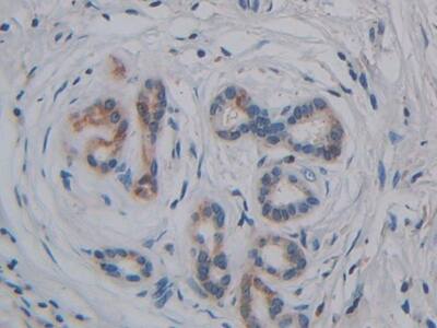 GPI-PLD/GPLD1 Antibody