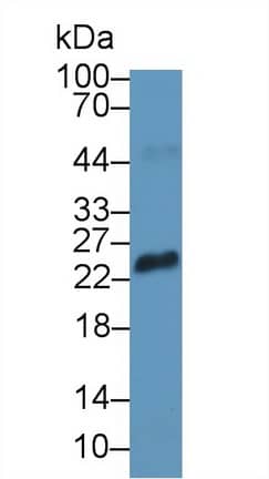 RS1 Antibody