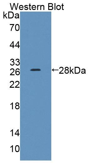 Nicotinic Acetylcholine R alpha 3/CHRNA3 Antibody