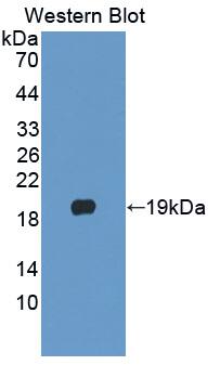 Phospholipase A2 X Antibody