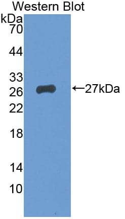 BCMO1 Antibody