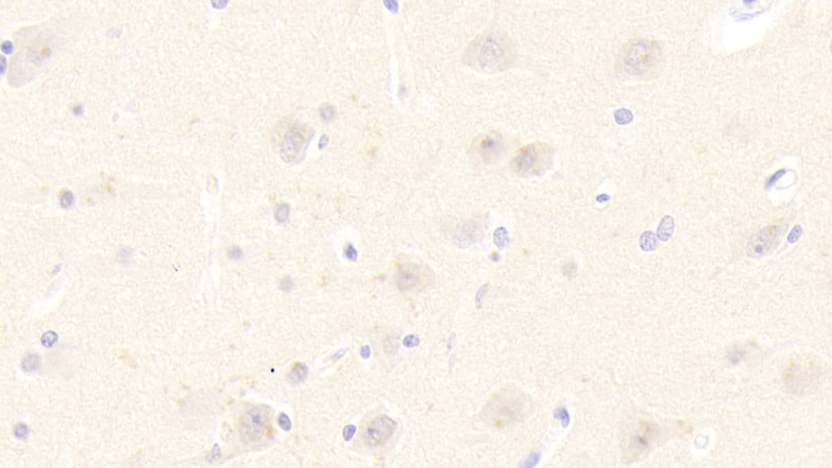 DNAJC4 Antibody