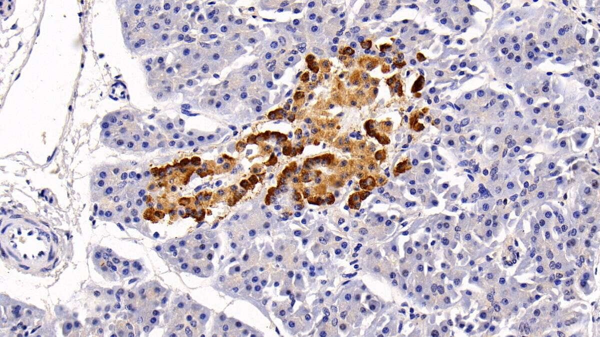 MTR Antibody