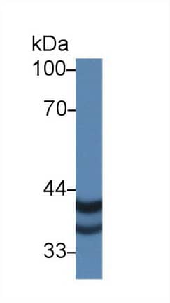 PSG2 Antibody