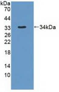 DYNC1H1 Antibody