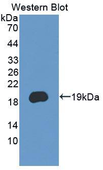 PCDH20 Antibody