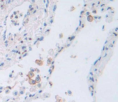 PCDH20 Antibody