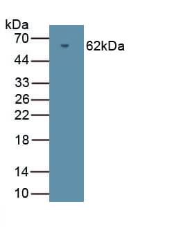 cGK2/PRKG2 Antibody