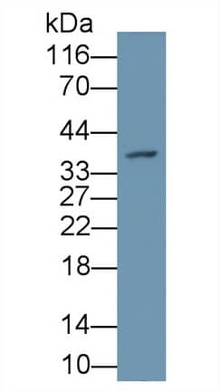 PAD3 Antibody