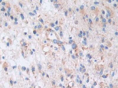 AKAP11 Antibody