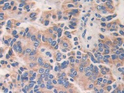 AKAP11 Antibody