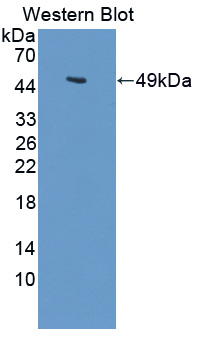 LARGE Antibody