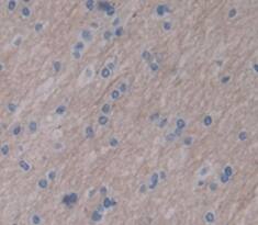 LARGE Antibody