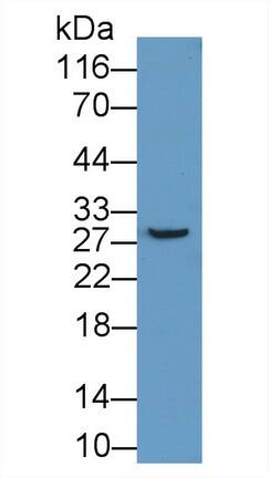 ABCA12 Antibody