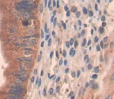 PIK4CA Antibody