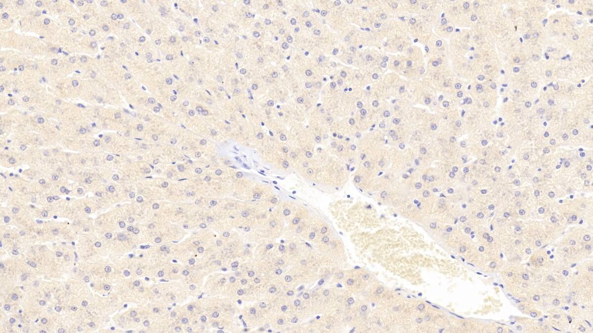 alpha Tubulin 3c Antibody