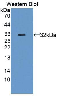 CROP Antibody