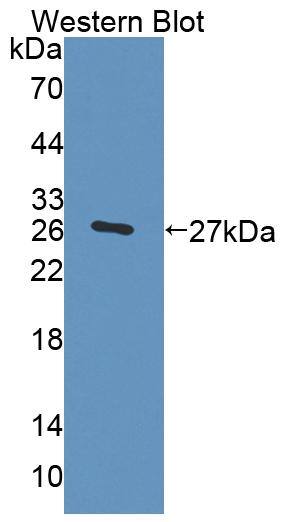 Trophinin Antibody