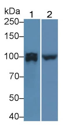 PTP pi/PTPRU Antibody