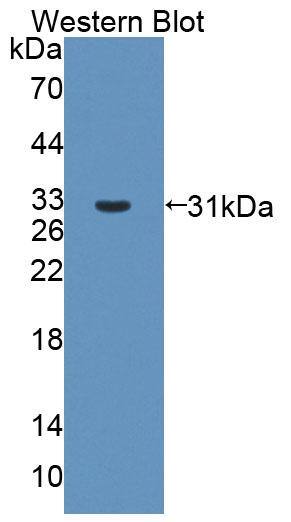 ABCB6 Antibody