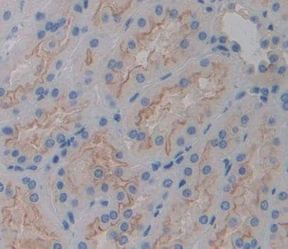 PLCH2 Antibody