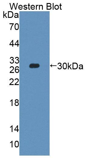 PLCH2 Antibody