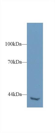 PLCH2 Antibody
